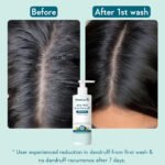 Wishcare AHA BHA Anti Dandruff Shampoo, 250 ml - Image 3