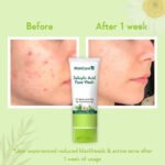 Wishcare 2% Salicylic Acid Face Wash 100ml - Image 3